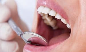 biopsia oral